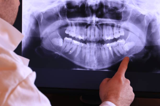 Best Urgent Dental Care for Toothache in Marshalltown, IA