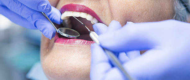 Best Emergency Dentist for Knocked-Out Tooth in Marshalltown, IA